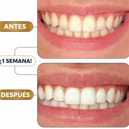 Tiras Blanqueadoras de dientes